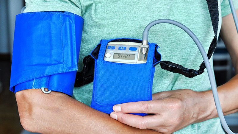 blood-pressure-monitoring-24hr-cardiologist